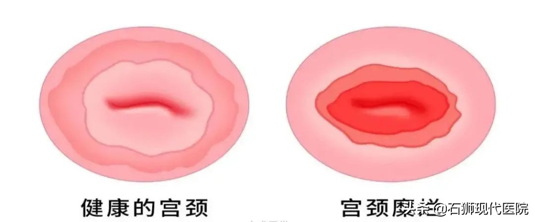 妇科体检主要查哪几项,妇科检查结果在哪里查