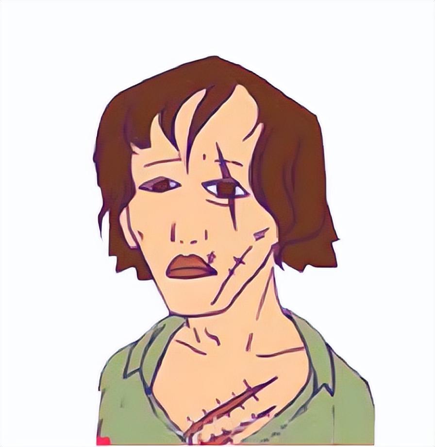 科普疤痕知多少,瘢痕科普视频