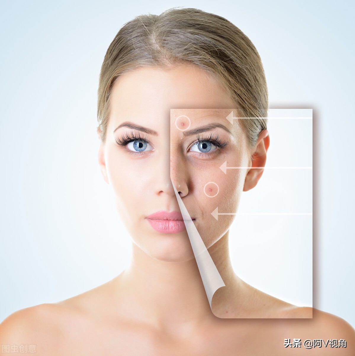 女孩脸上长痘痘最好的治疗方法,女孩脸上长痘痘的原因及治疗方法