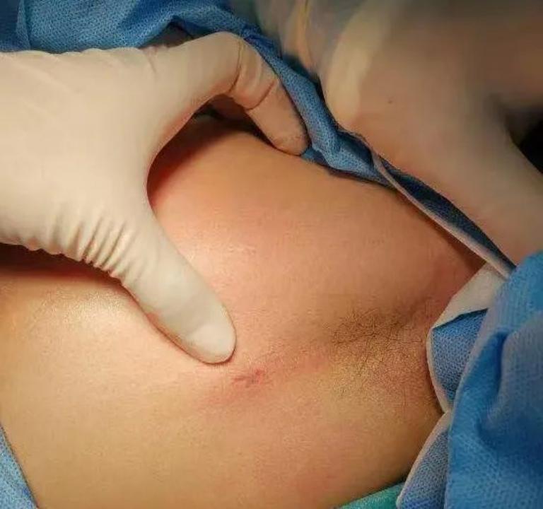 手心长期出汗是什么原因怎样治疗,手心出汗多的原因及解决方法