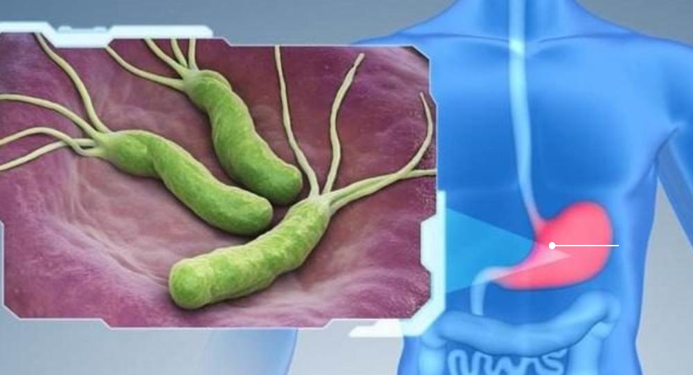 胃溃疡主要护理问题及措施,胃溃疡如何保养护理