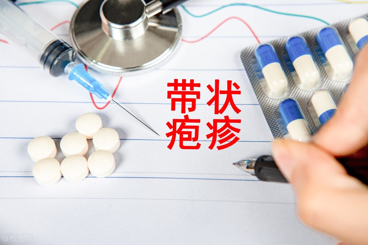 有一种疼痛就是带状疱疹的痛,有一种剧痛叫带状疱疹得了怎么治