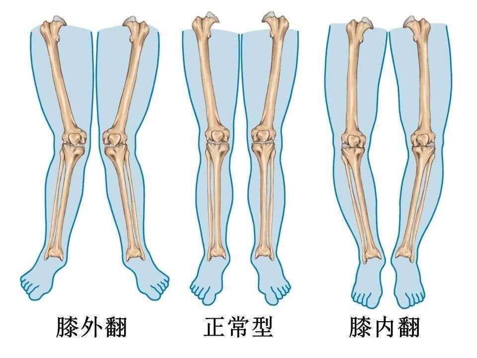 给新生儿绑腿科学吗,宝宝晚上绑腿睡觉能矫正腿型吗