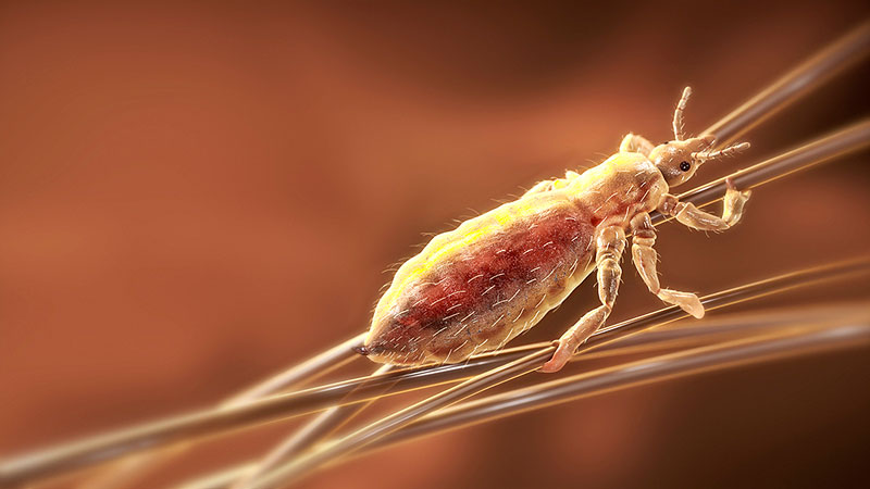 曾经无孔不入的虱子是怎么来的？为何如今很少看到了？