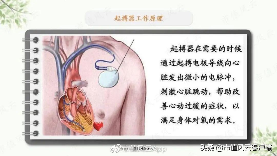 先健科技估值,先健科技业绩大全