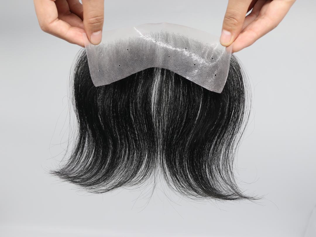 发际线后移遗传吗,发际线后移怎么办适合什么发型