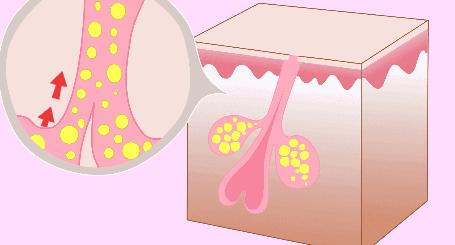 让你又爱又恨的面霜,让人们又爱又恨的软件