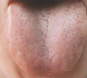 失眠4种中成药解决你的睡眠难题,失眠彻底治愈的七大方法