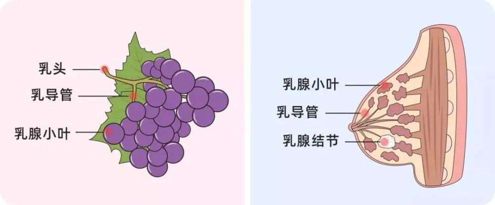 乳腺增生结节怎么消除中成药,乳腺囊性增生吃什么中成药好
