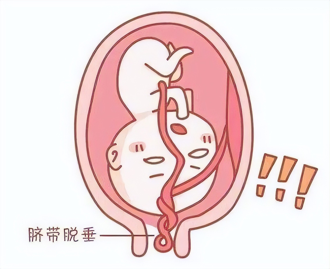 切除子宫输卵管卵巢会影响心情吗,中年女性把子宫切除了有什么影响