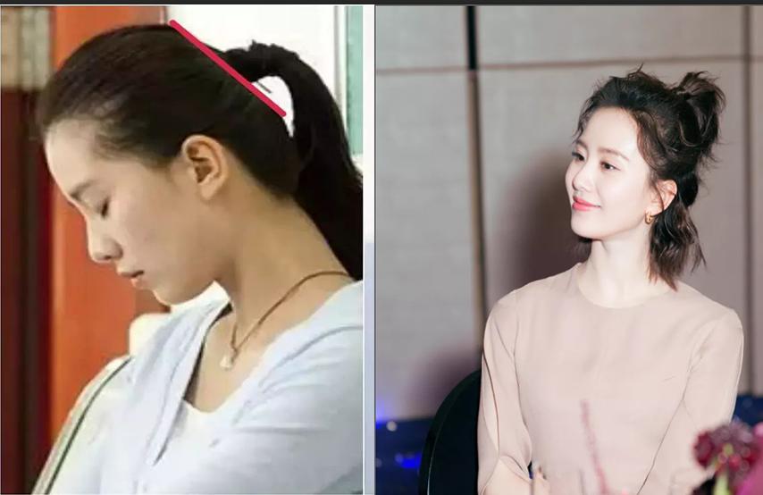 扁头真的比圆头难看吗,为啥以前流行扁头现在流行圆头