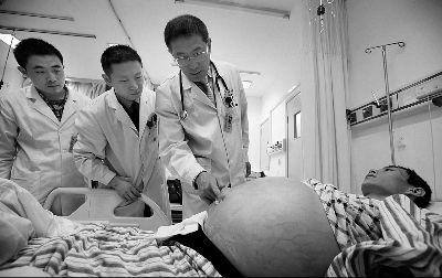 老人去医院检查五脏六腑离奇消失,50岁大爷五脏六腑离奇消失