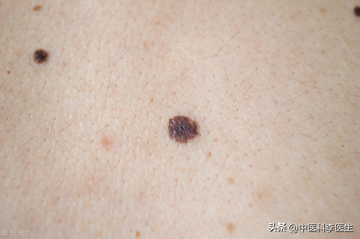 早期17种癌症治愈率排名,早期癌症治愈率最大可达95%以上