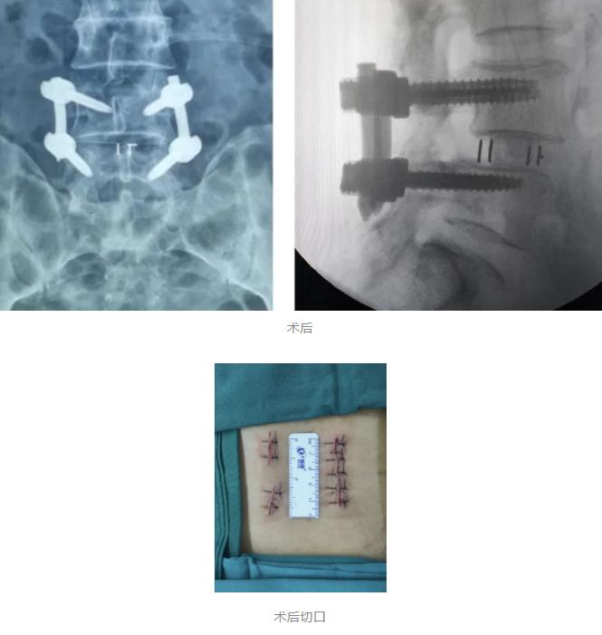 骨科看腰背痛做什么检查,腰背疼骨科检查没问题应该怎么办