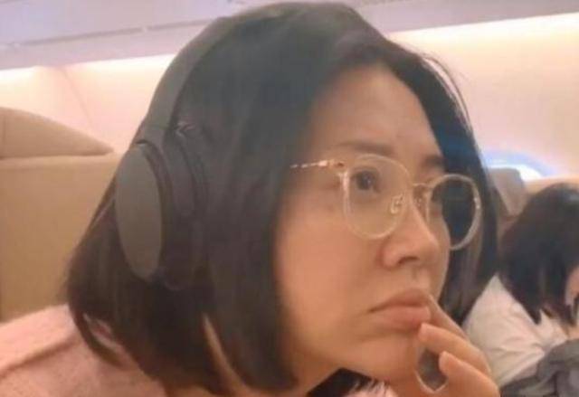 面部衰老皱纹解剖图,面部皱纹衰老对比图