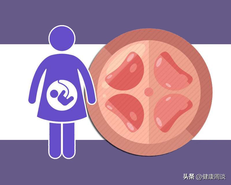 怀孕发现有子宫肌瘤该怎么办,怀孕期间发现子宫肌瘤