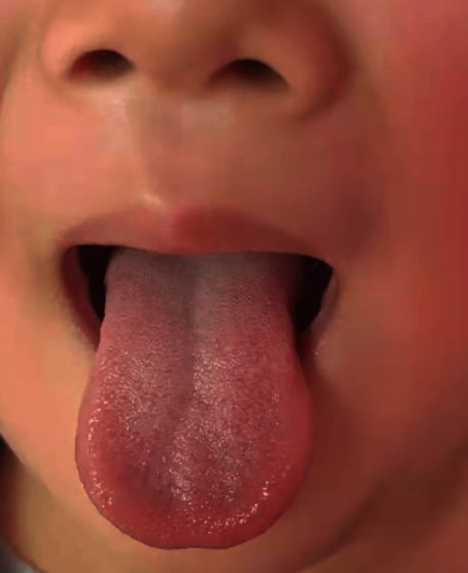 孩子6岁才108怎么办,6岁小孩生病