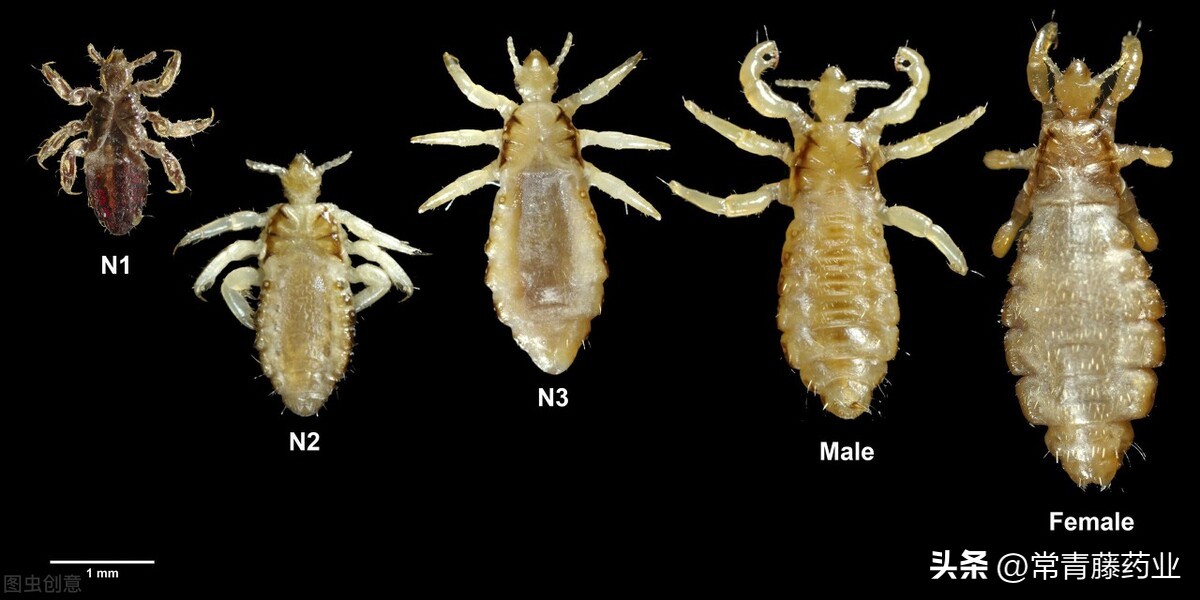 虱子和虮子,虱子和虱子有什么不同