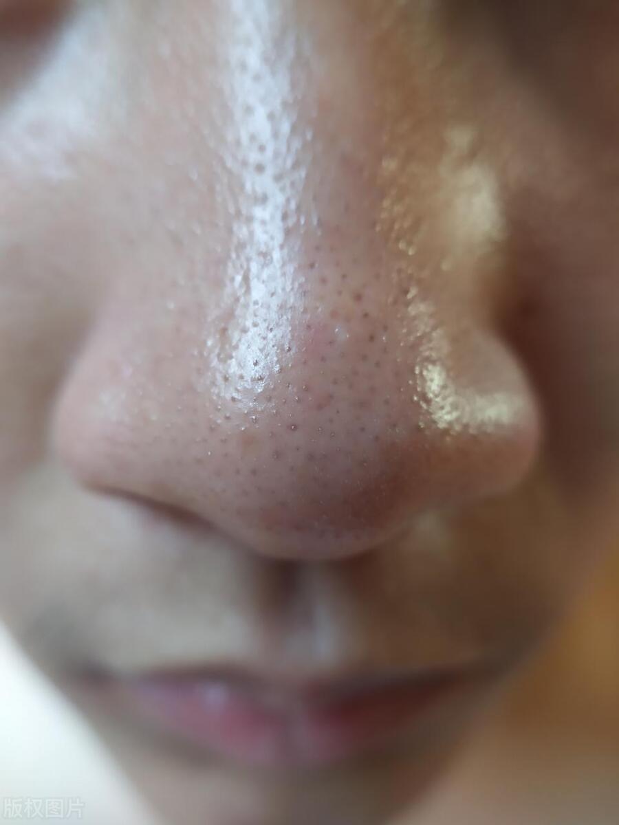 男士夏季护肤的正确步骤,夏季男士护肤小窍门有哪些