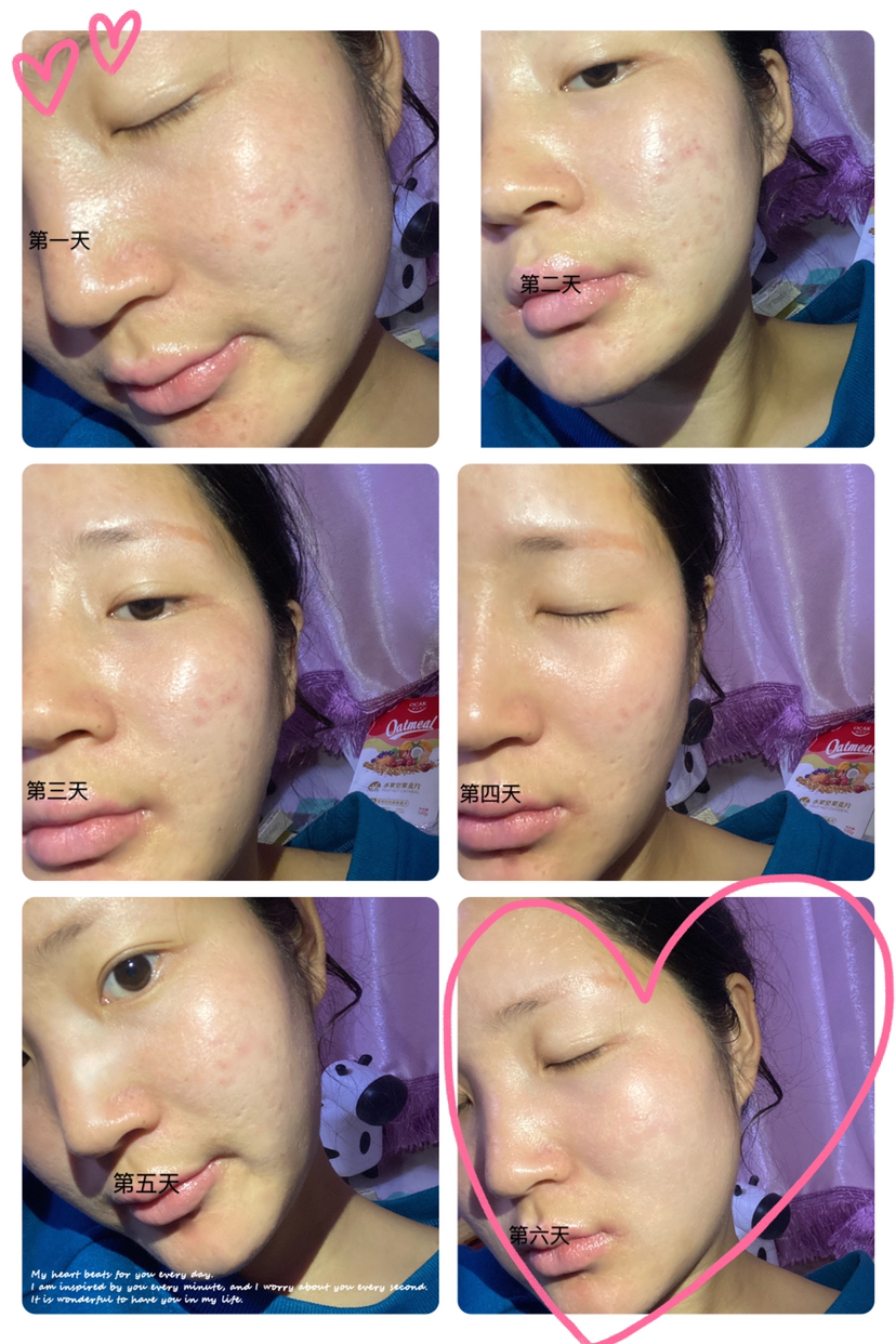 寻荟记芦荟胶,寻荟记芦荟胶老爸评测