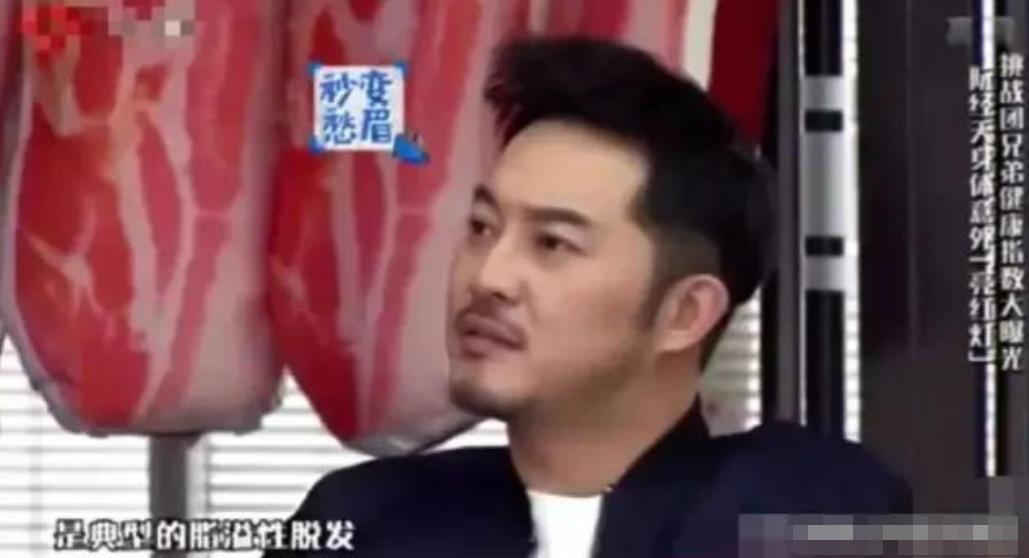 发际线秃的男星,盘点十大秃头男星佩戴假发