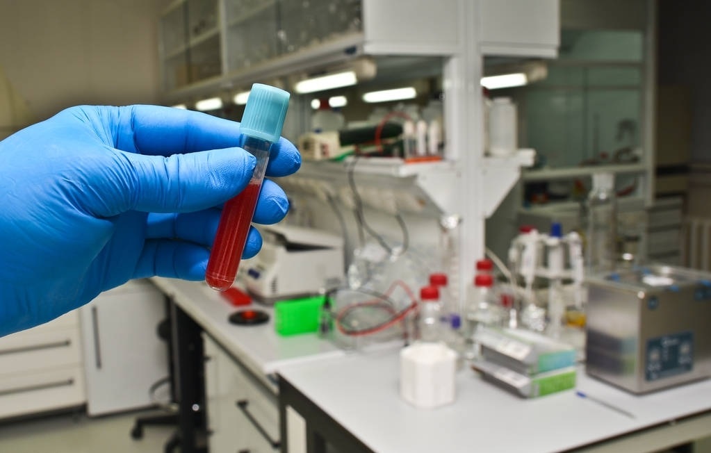 叶酸维生素c可以预防脑梗塞吗,叶酸治疗脑梗塞的最好方法