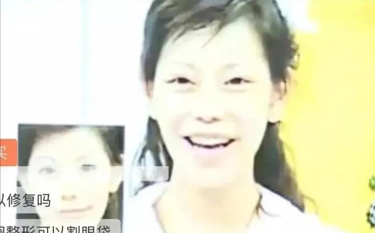 盘点那些整容整的最厉害的人,整容整的最厉害的三位女士