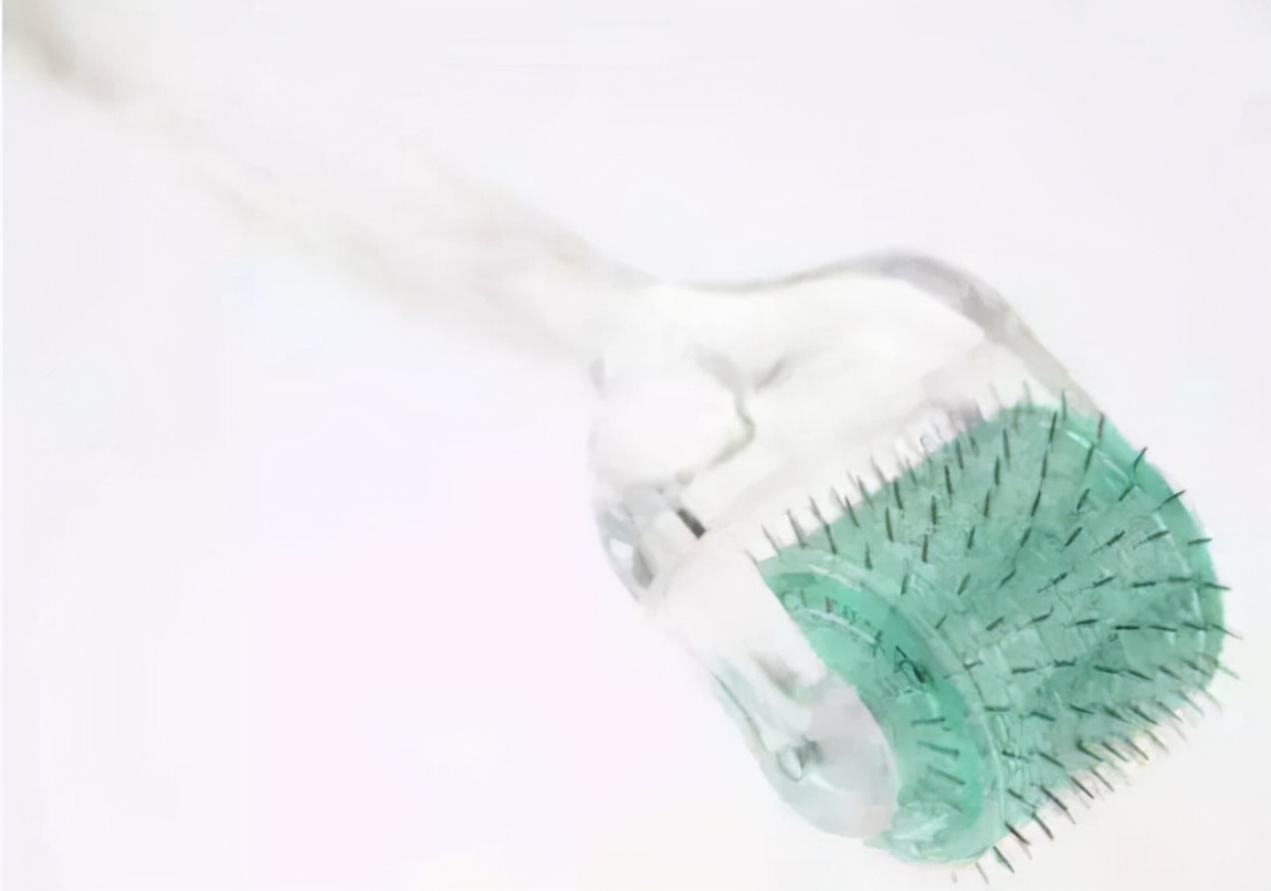 微针祛痘印后需要注意什么,做完面部微针之后应该注意什么