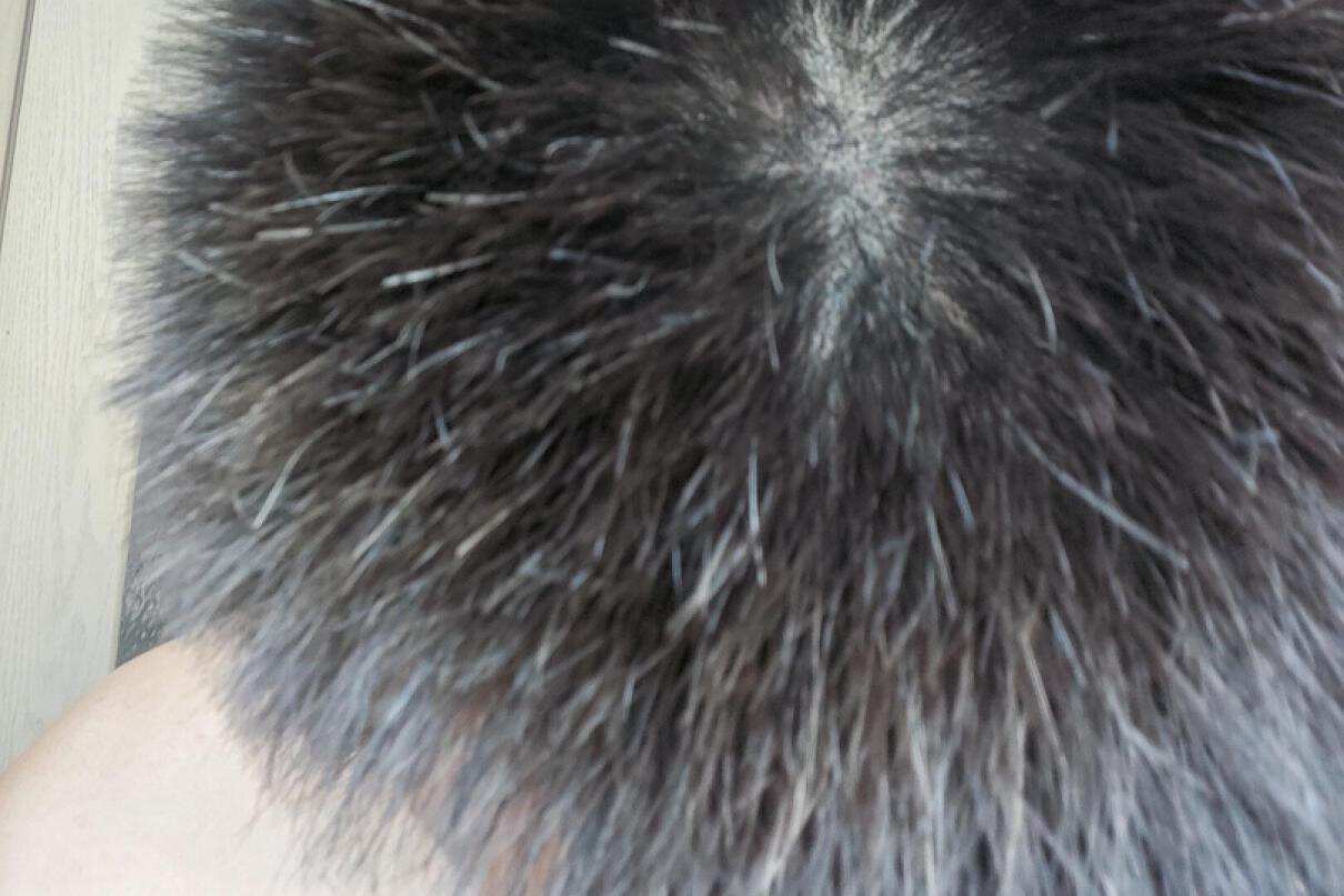 去头皮屑防掉发的洗发水推荐,脱发痒用哪一款洗发水比较好