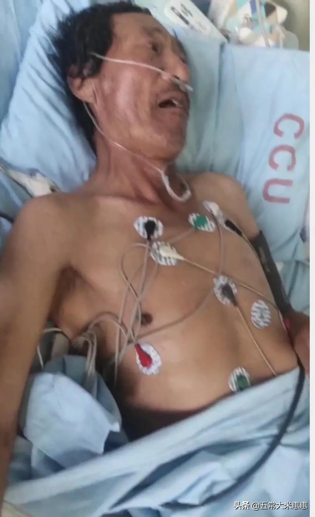 心脏支架后喘不上气,老人做完心脏支架后不能说话