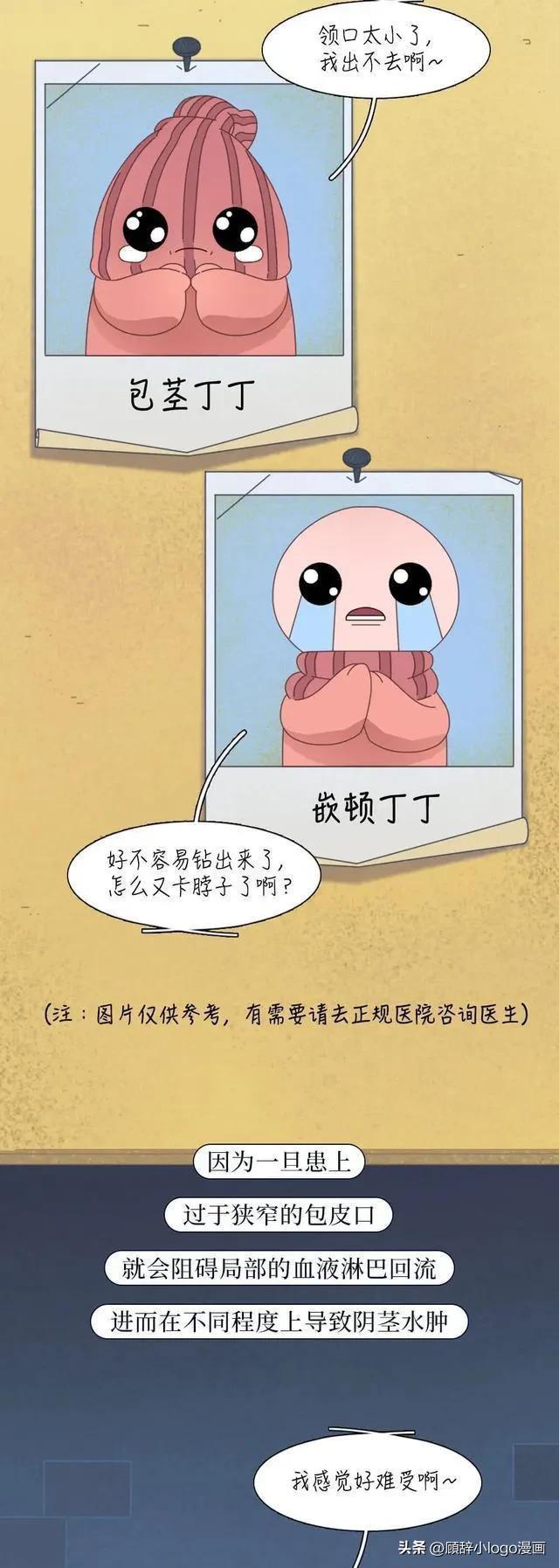 男生割包皮后发生什么变化,男生割包皮以后的变化