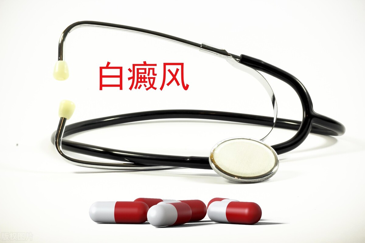 脖子有浅白斑是白癜风吗,脖子上有白斑是白癜风还是汗斑