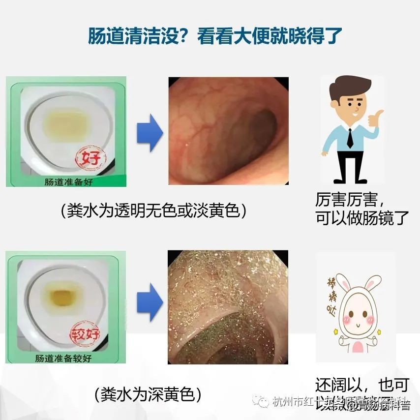 省人民医院胃肠镜检查须知,肠镜胃镜检查须知