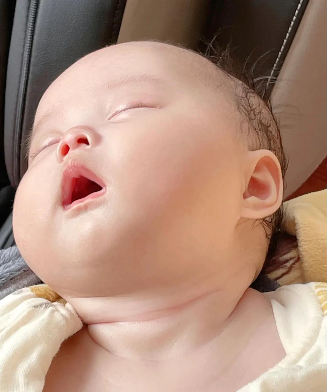 新生儿淹脖子发红怎么处理,宝宝淹脖子泛红涂什么最好