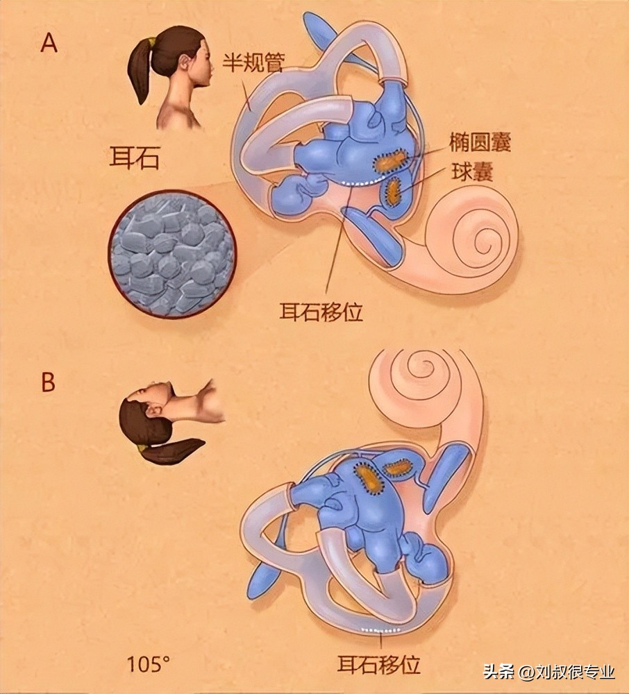 耳石症是耳鼻喉常见病吗,耳石症到底是看什么科医生