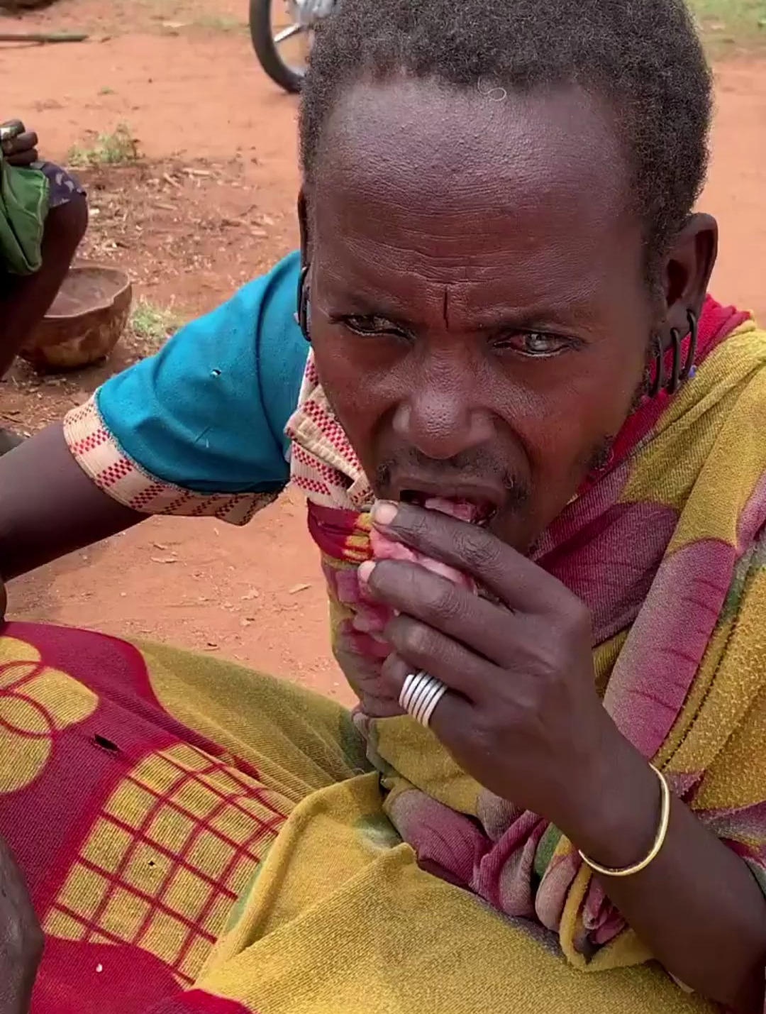 如果人吃生肉会怎样,秃鹫的胃酸那么强胃不会坏吗