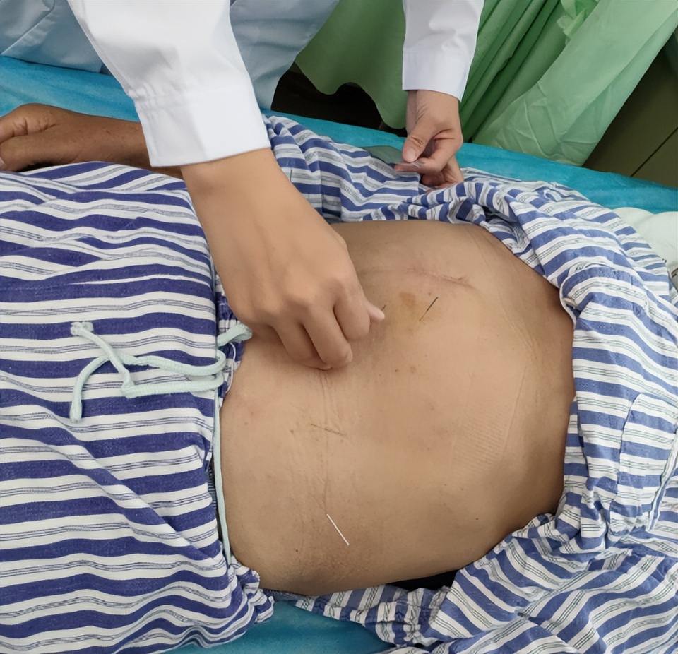 乳腺癌术后淋巴水肿的中医外治,乳腺癌术后游泳会引起淋巴水肿吗