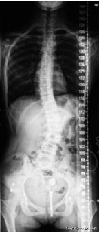 x光片不清晰是拍摄人员的问题吗,x光片可能会拍错吗