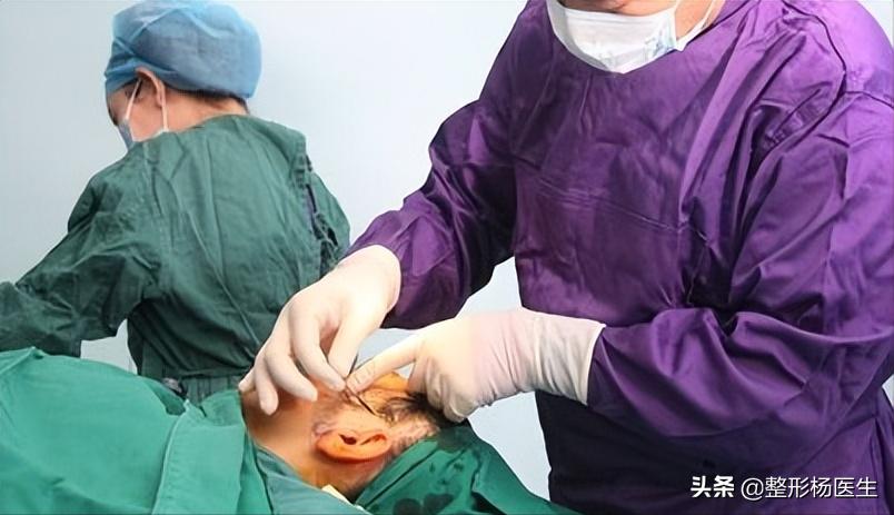 拉皮手术后遗症怎么治,拉皮手术好不好