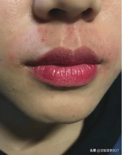 用过两三次脱毛膏会不会致癌,千山暮雪脱毛膏有致癌风险吗