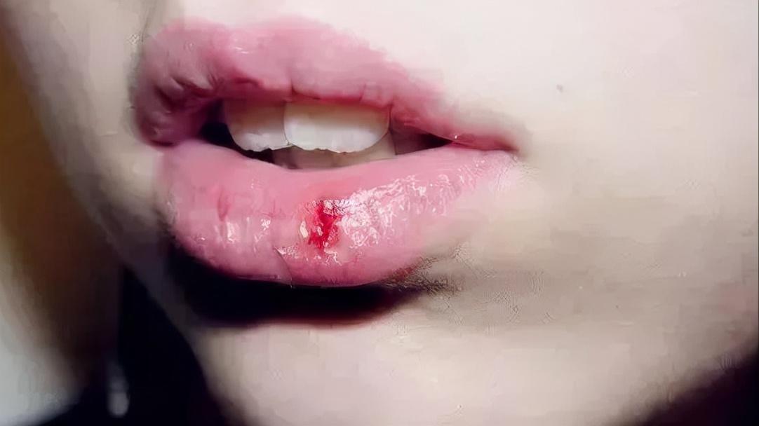 小孩身上有小红点抹啥药,孩子身上起了一个化脓性肉芽肿