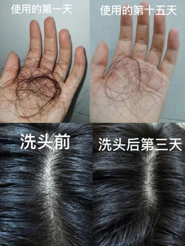 生发洗发水大牌第一名,发根干枯防脱生发洗发水排名第一