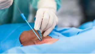 中心静脉导管相关并发症最严重,中心静脉常见并发症的预防及处理