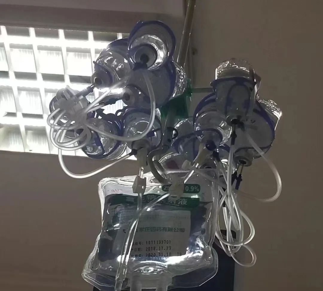 丙种球蛋白对治疗新冠重症有用吗,丙种球蛋白目前紧俏吗