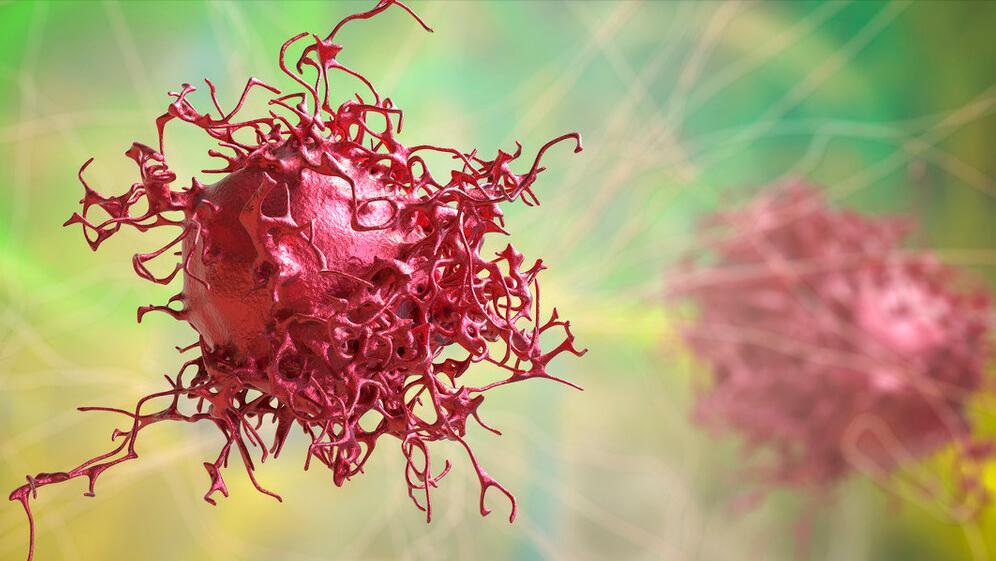 外阴癌什么原因造成的,外阴癌生活中需要注意什么