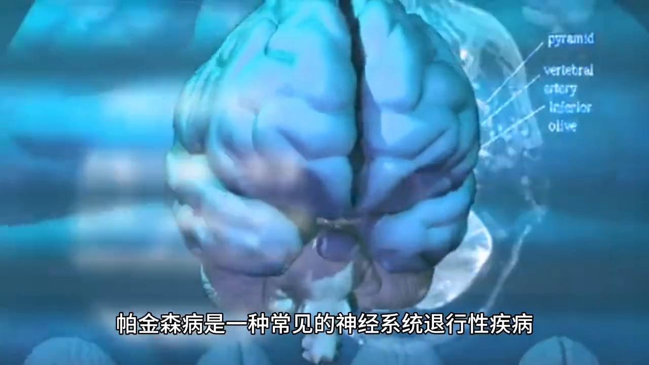 视频涨知识|帕金森病的治疗方法