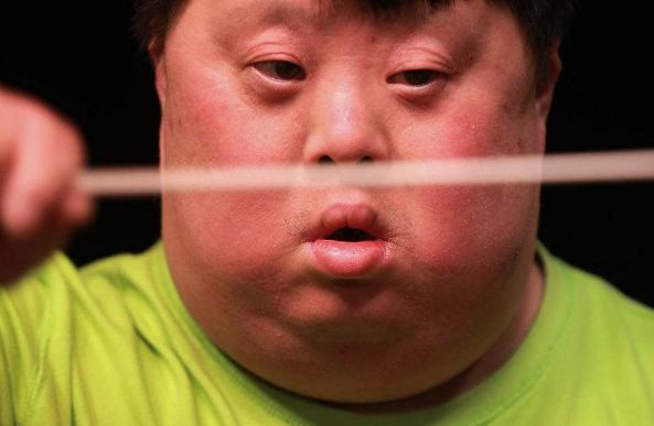 指挥家舟舟癌症,41岁指挥家舟舟纪录片