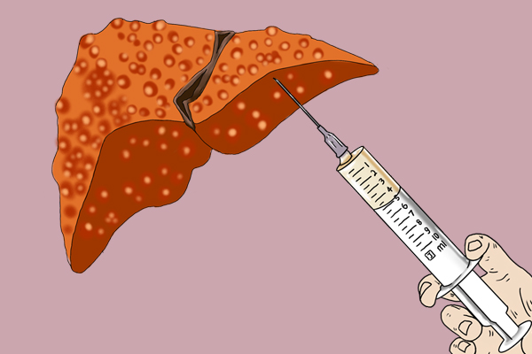 长在身体哪些部位的痣要特别注意,身上长的痣哪一种痣最危险