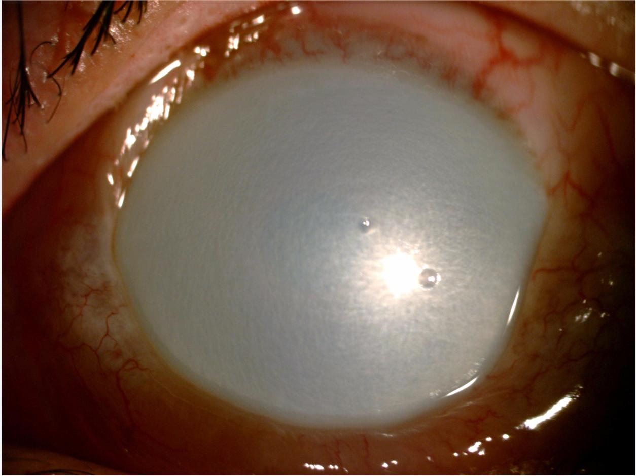 火碱溅入眼睛怎么办,大扫除火碱