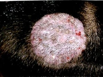 4岁儿童突然脱发严重是怎么回事,4岁儿童脱发严重该怎么办